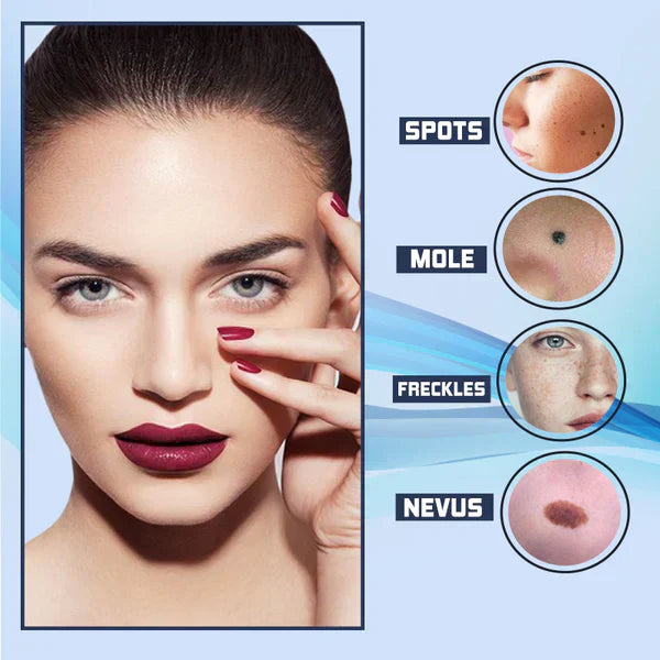 SpotClear™ Dark Spot Vanisher in Just a Few Weeks