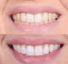 SmileLuxe™ Instant Fresh Smile Magic