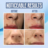 SpotClear™ Dark Spot Vanisher in Just a Few Weeks