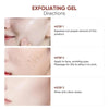 ClearTouch™ Blemish Control Care