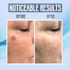 SpotClear™ Dark Spot Vanisher in Just a Few Weeks