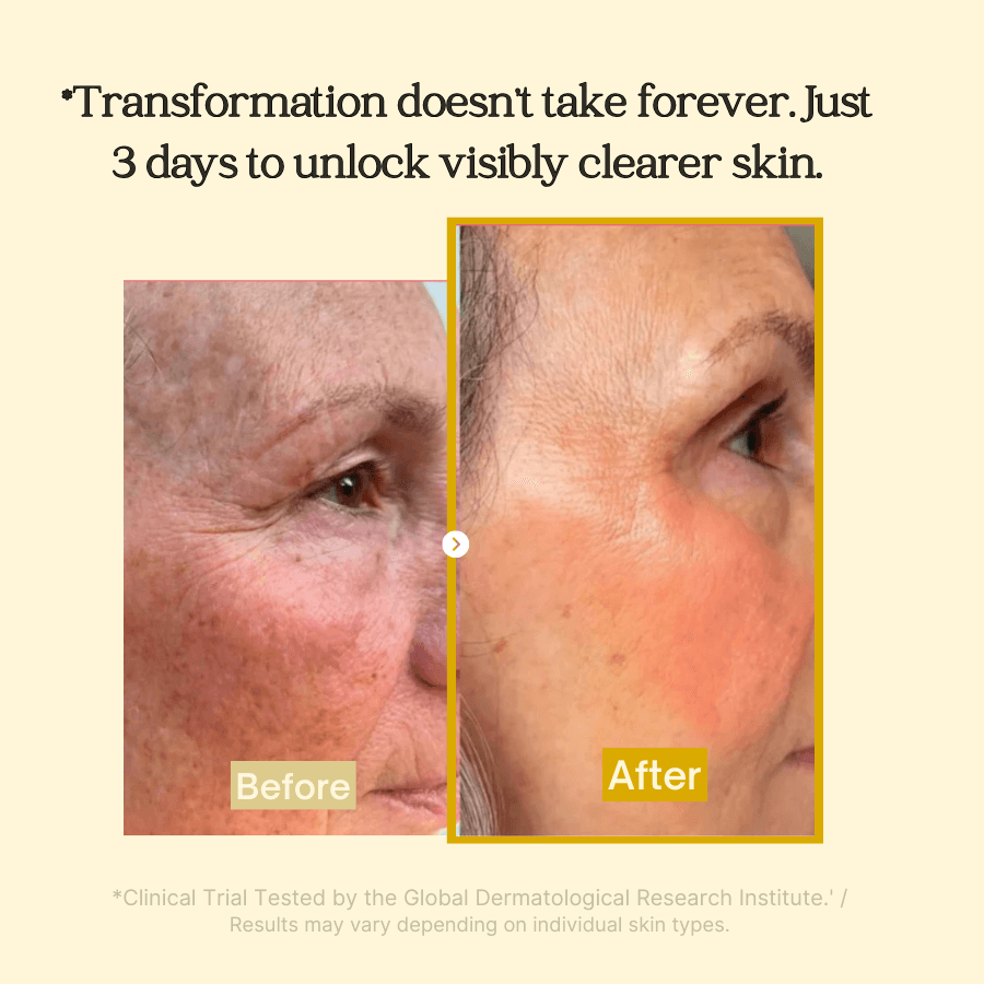 2+2 Free | LumeSkin™ Clear Bright Complexion