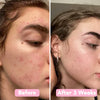 GlowPurify™ Radiance Renewal Cleanse