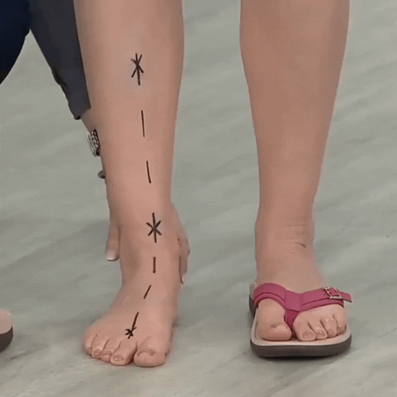 Annaliza™ Orthopaedic Summer Sandals