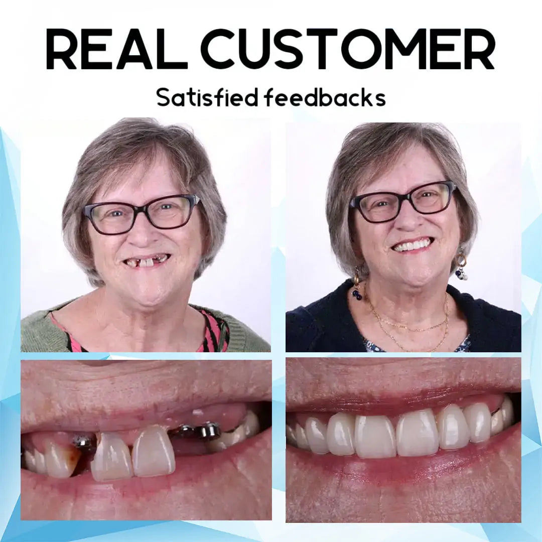 SmilePro™ Smiling Confidence All Day Long