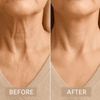 YouthStrip™ Wrinkle-Free Confidence