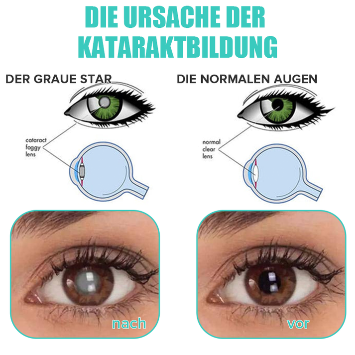 EyeRevive™ Refresh Tired Vision Instantly