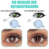 EyeRevive™ Refresh Tired Vision Instantly