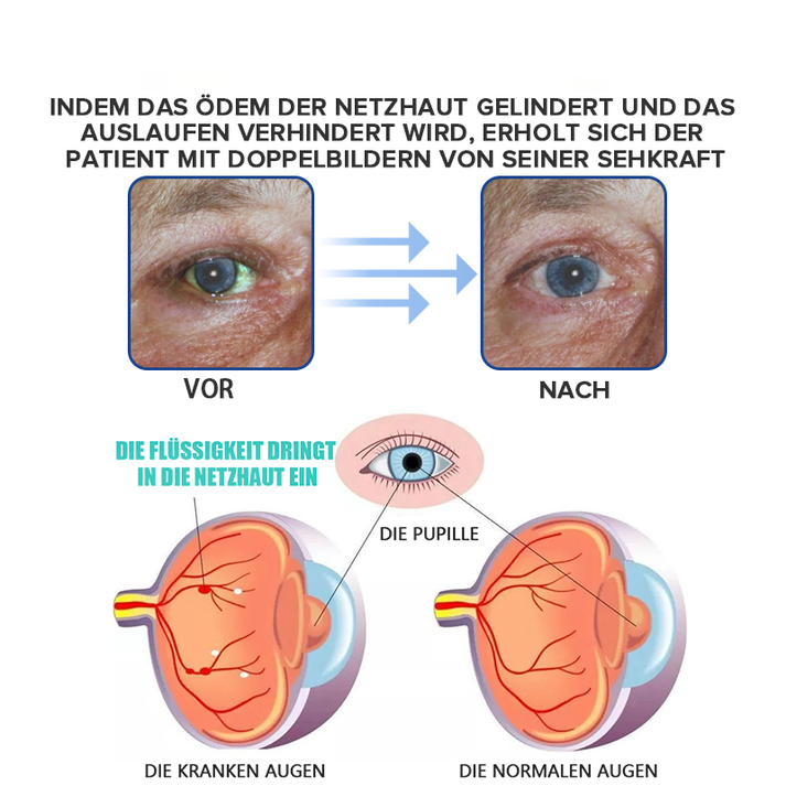 EyeRevive™ Refresh Tired Vision Instantly