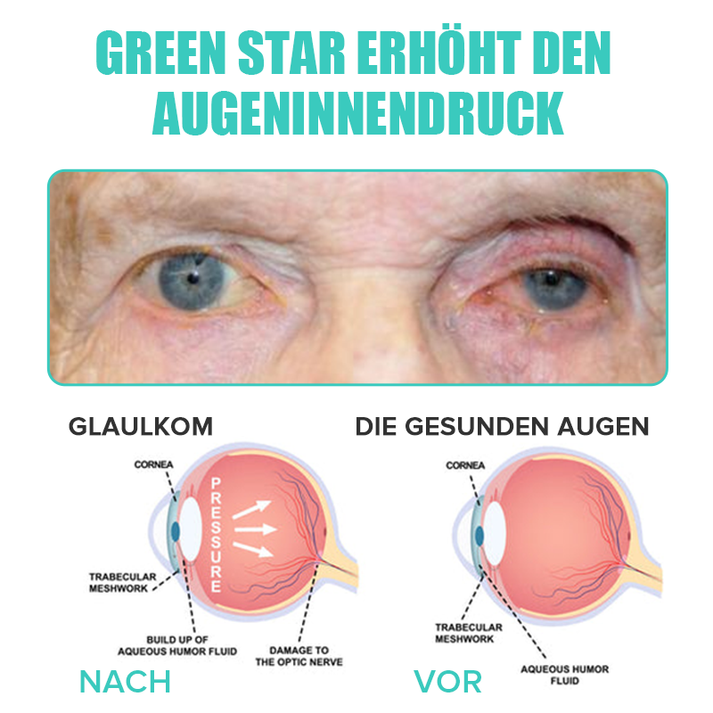 EyeRevive™ Refresh Tired Vision Instantly