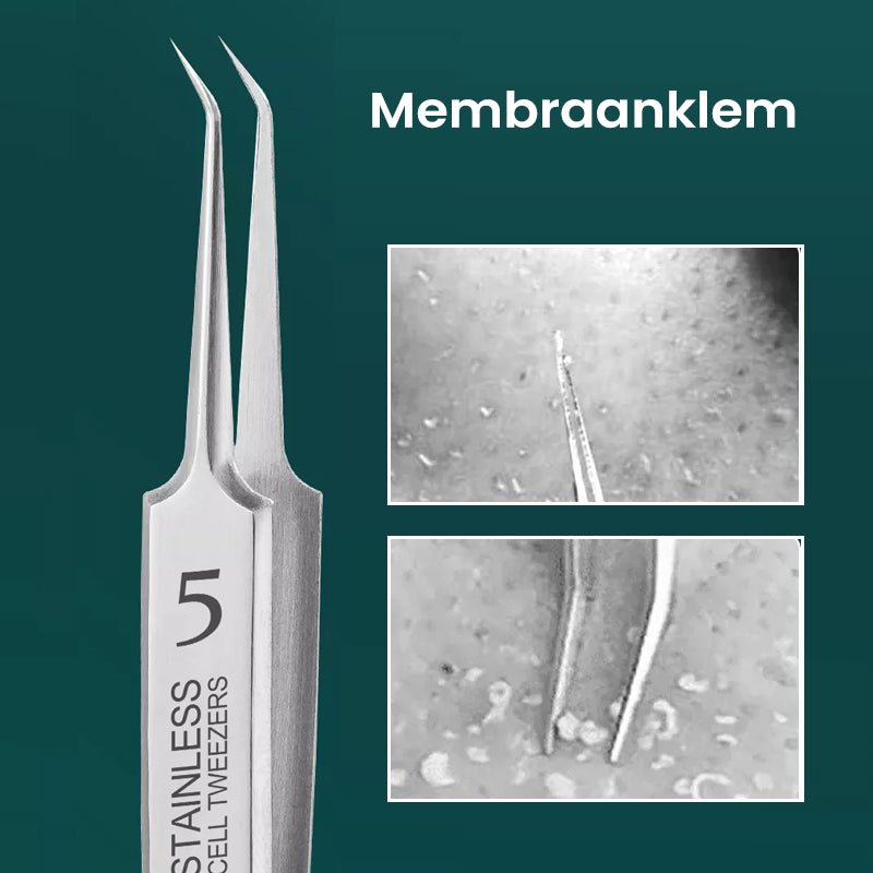TweezeClear™ Targeted Blemish Extraction