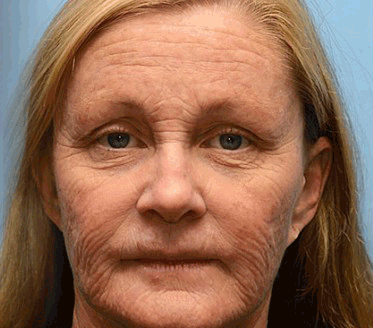 2+2 Free | FirmTouch™ Smooth Skin Boost