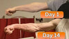 ArmStrong™ Improves Grip Strength