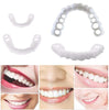 SnapLock™ Snap-In Dentures